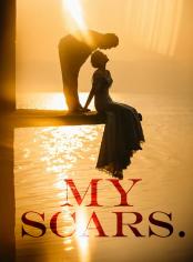 My scars.